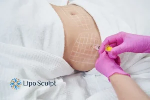 Are The Results From Aqualyx Permanent? 1 Do you want to know how long Aqualyx Gerrards Cross results last?
