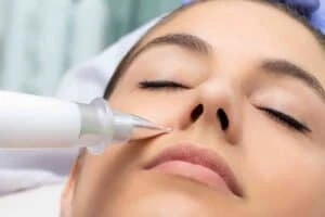Best Actinic Keratoses Removal 3 Actinic keratoses Gerrards Cross solutions - book in today!