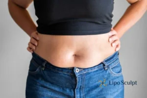 Bidding Farewell to Muffin Tops with Aqualyx Fat Injections 2 Do you wish you could reduce your muffin top Gerrards Cross With Aqualy fat dissolving injections you can!